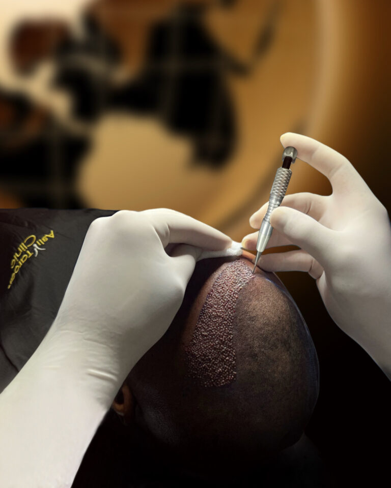 Saç Ekimi Sonrası Uyuşukluk