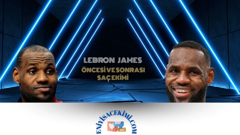 Lebron James Saç Ekimi Öncesi ve Sonrası