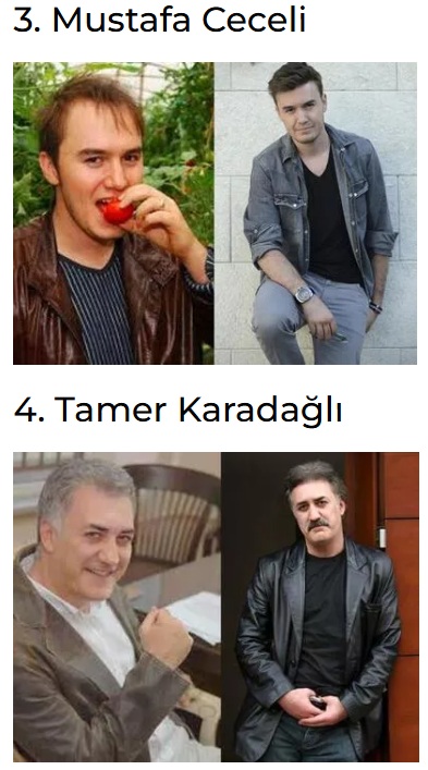 Saç ektiren ünlüler değişimleri!